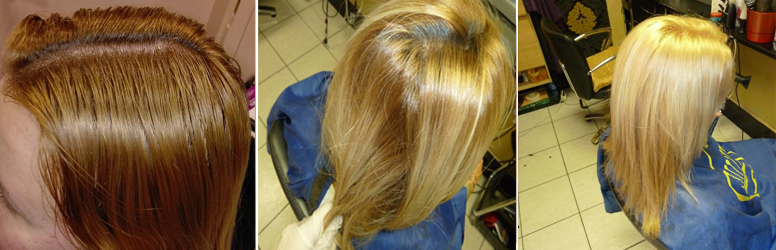 Fortuna hajgyógyászati kezelés